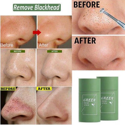 Blackhead Remover Stick Mask for Moisturized Skin and Oil Control