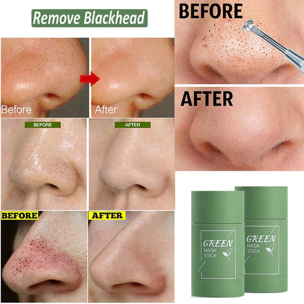 Blackhead Remover Stick Mask for Moisturized Skin and Oil Control