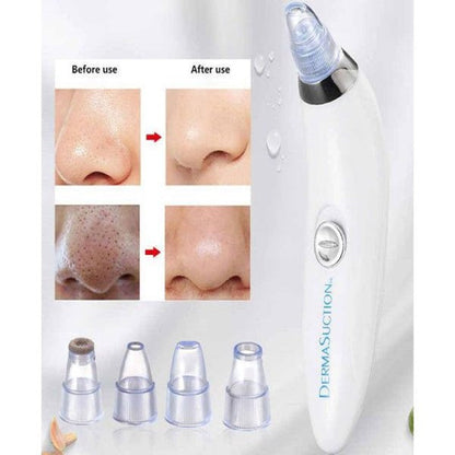 Professional Derma Suction Blackhead Remover for Clear and Radiant Skin